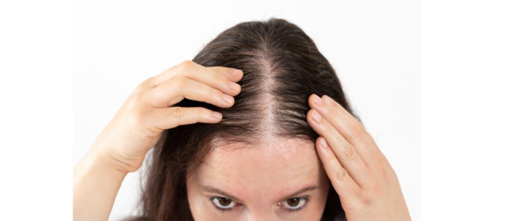 Early Signs of a Widening Hair Parting
