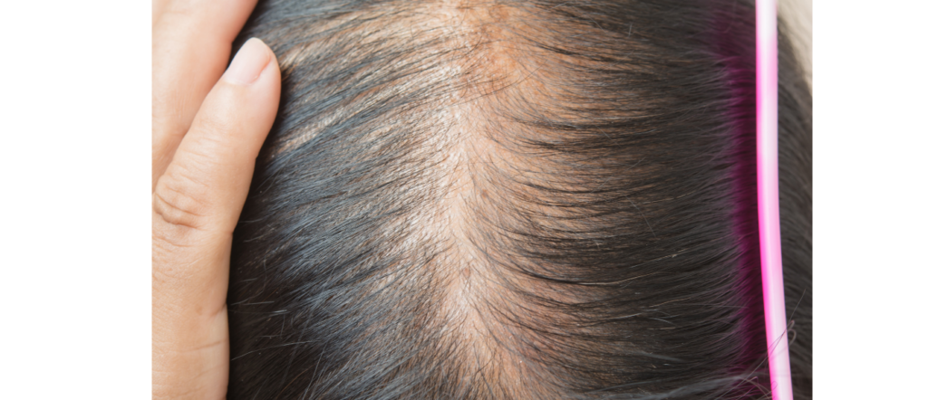 Woman looking at her parting in the mirror, noticing more visible scalp and reduced density