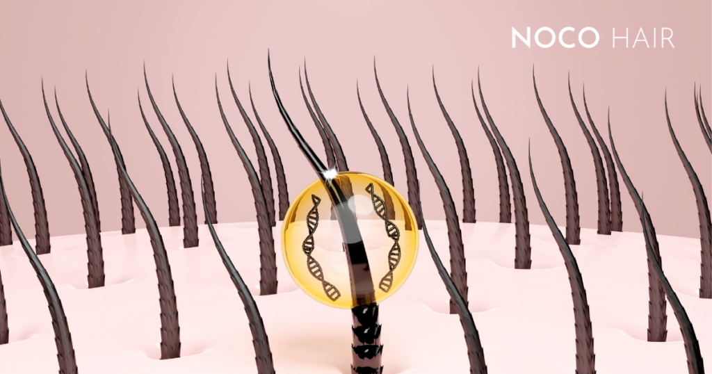 Medical illustration of the early stage of hair regrowth, showing hair follicles pushing through the scalp as hair begins to grow back.